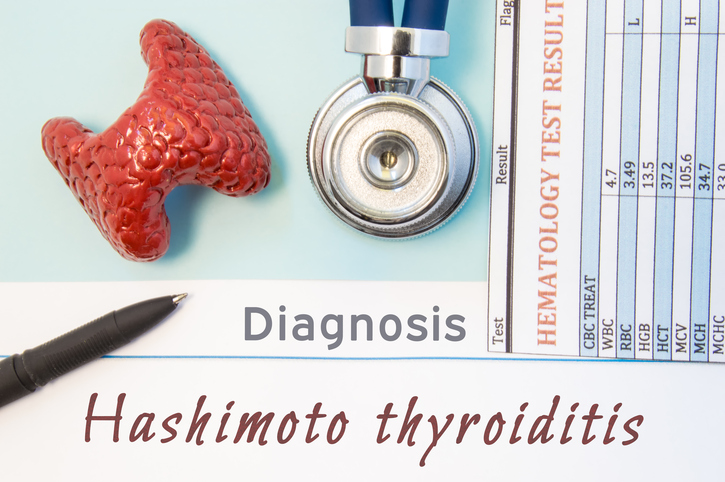 Autoimmune hypothyroidism aka Hashimoto’s