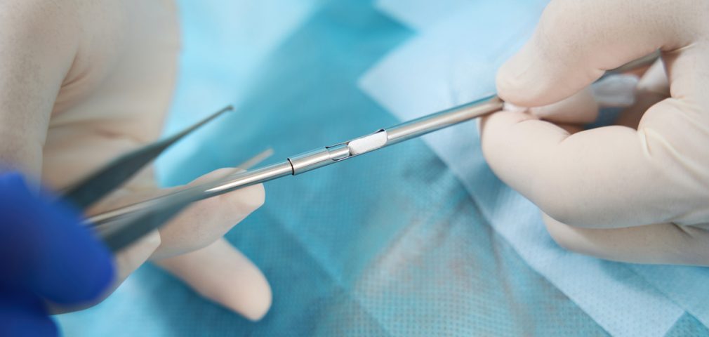 Specialist holds in his hands tools for installation of bioidentical hormones